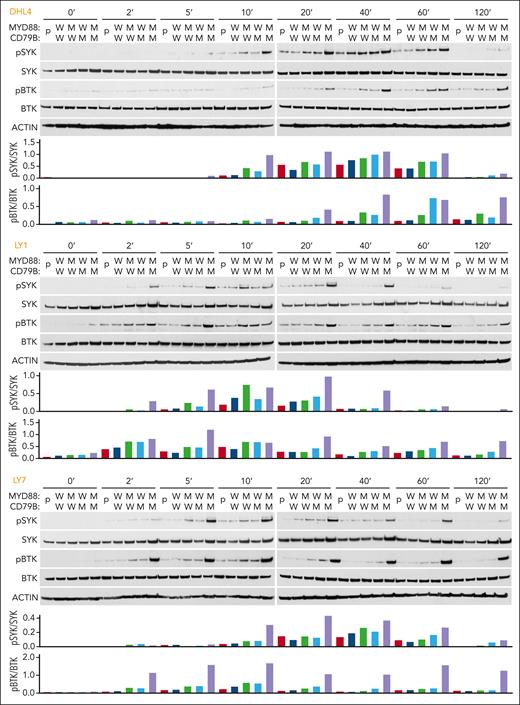 MYD88L265P and CD79BY196F coexpression augments proximal BCR signaling in DLBCL. For each cell line: (Top) Immunoblot of pSYK, SYK, pBTK, and BTK in engineered DHL4, LY1, and LY7 cells at baseline and 2, 5, 10, 20, 40, 60, and 120 minutes after BCR crosslinking. (Bottom) Densitometry analysis of protein bands. Actin was used as a loading control. Data are representative of 1 of 3 independent experiments.