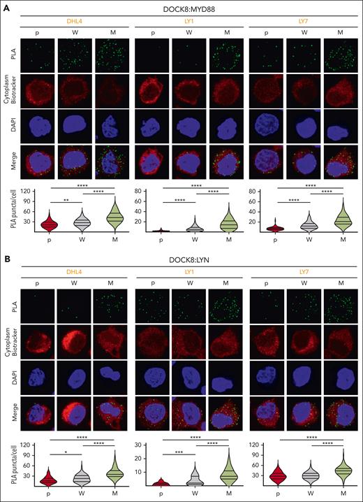 MYD88L265P expression increases the colocalization of MYD88 with DOCK8 and DOCK8 with LYN in DLBCL. (A) (Top) Confocal images of MYD88:DOCK8 PLA signals in DHL4, LY1, and LY7 parental (p), MYD88WT (W)-, or MYD88L265P (M)-overexpressing cells. (Bottom) Quantification of PLA signals in n > 60 cells classified per condition. Violin plots, ∗∗P < .01; ∗∗∗∗P < .0001. (B) (Top) Confocal images of LYN:DOCK8 PLA signals in DHL4, LY1, and LY7 p, W-, or M-overexpressing cells. (Bottom) Quantification data of n > 40 cells classified per condition. Violin plots, ∗P < .05; ∗∗∗P < .001; ∗∗∗∗P < .0001. Asterisks represent P values in a Mann-Whitney test.