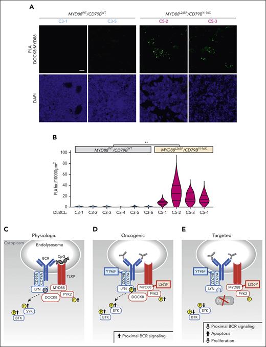 Colocalization of MYD88 and DOCK8 in primary DLBCLs and schema of augmented proximal BCR signaling in MYD88L265P/CD79BY196X DLBCLs. (A) Confocal images of MYD88:DOCK8 PLA signals in 2 representative C3 (MYD88WT/CD79BWT) and 2 representative C5 (MYD88L265P/CD79BY196X) primary DLBCLs. Scale bar, 10 μm. (B) Quantification of PLA signals in primary DLBCLs. PLA puncta in 10 000 μm2 areas from triplicate core biopsies from 6 C3 (MYD88WT/CD79BWT) and 4 C5 (MYD88L265P/CD79BY196X) primary DLBCLs were scored. Violin plots, ∗∗P < .01. Asterisks represent P values in a Mann-Whitney test. (C) Physiologic signaling. CpG-induced TLR signaling augments PYK2 phosphorylation and phosphorylation of the proximal BCR kinases SYK and BTK. DOCK8 phosphorylation, shown in gray, was previously demonstrated.29 (D) Oncogenic signaling. MYD88L265P increases PYK2 and DOCK8 phosphorylation and phosphorylation of SYK and BTK. (E) Therapeutic targeting. DOCK8 depletion decreases SYK and BTK phosphorylation and is selectively antiproliferative and cytotoxic in MYD88L265P/CD79BY196F cell lines. TLR pathway members are shown in red; BCR pathway members are shown in blue.