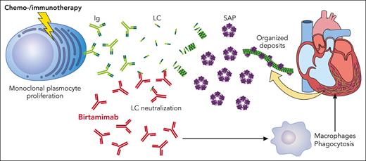 New therapeutic approaches in the treatment of amyloidosis. Ig, immunoglobulin. Professional illustration by Patrick Lane, ScEYEnce Studios.