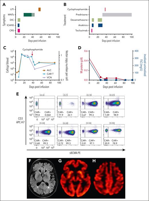 Massive CAR T-cell expansion coincides with toxicity. (A) Time course of adverse events following CAR T-cell infusion. The change in color of the MNTs indicates the timing of cyclophosphamide. (B) Therapeutic strategies deployed for CAR T-cell–related toxicity. (C) Absolute lymphocyte count (ALC) and CAR T-cell count (cells/μL blood) are plotted on the left y-axis, and vector copy number (VCN) per cell is plotted on the right y-axis. Absolute CAR T-cell number decreases following cyclophosphamide therapy, but CAR T cells remain the predominant population of circulating lymphocytes. (D) M protein is plotted on the left y-axis, and the difference between involved and uninvolved serum-free light chains is plotted on the right y-axis. Both biomarkers decrease rapidly following CAR T-cell infusion and remain low for the duration of follow-up, consistent with an ongoing stringent complete response. (E) Immunophenotyping demonstrates CAR T-cell expansion, gated on CD3+, viable lymphocytes. (F) Magnetic resonance imaging (MRI) of the brain showed that the caudate, striatum, and other structures comprising the basal ganglia were normal. A prior comparison MRI of the brain was not available. (G-H) Brain (18)F-fluorodeoxyglucose–positron emission tomography images showed normal metabolic activity in the basal ganglia and occipital lobes (G) and mild bilateral hypometabolism in the frontal lobes, anterior cingulate gyri, and, to a lesser degree, parietal lobes (H). APC, allophycocyanin; DIC, disseminated intravascular coagulation; FLC, free light chains; PE, phycoerythrin; sBCMA, soluble BCMA; UTI, urinary tract infection.