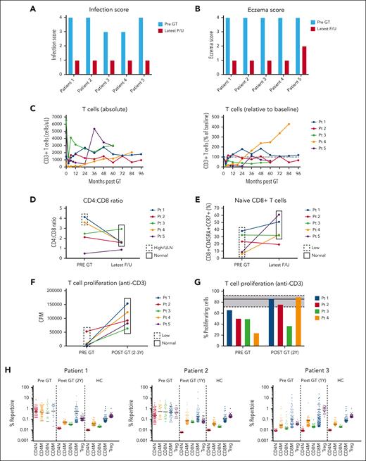 Reconstitution of cellular immunity. (A) Infection scores before and after GT (scoring includes events during the last year of F/U; median, 7.6 years; range, 5.3-8.8 years). (B) Eczema score before and after GT (scoring includes events during the last year of F/U; median, 7.6 years; range, 5.3-8.8 years). (C) Reconstitution of T cells after GT (left: absolute values; right: relative to baseline). (D) Comparison of CD4+:CD8+ T-cell ratio before and after GT (at latest F/U). (E) Comparison of percentage of naive CD8+ T cells (at latest F/U). (F) Evaluation of T-cell proliferation in response to anti-CD3 by thymidine incorporation assay (at 2-3 years after GT) and (G) by carboxyfluorescein succinimidyl ester proliferation assay (at 2 years after GT), data not available for patient 5. The shaded area represents the median with interquartile ranges of healthy controls (n = 21). (H) Deep sequencing of TCR repertoire (patient 1, 2 years after GT; patient 2, 1 year after GT; patient 3, 1 year after GT). The frequency of the top 100 most abundant unique clonotypes is expressed as a percentage of the total number of sequences obtained. F/U, follow-up; HC, healthy control; ULN, upper limit of normal; Y, year.