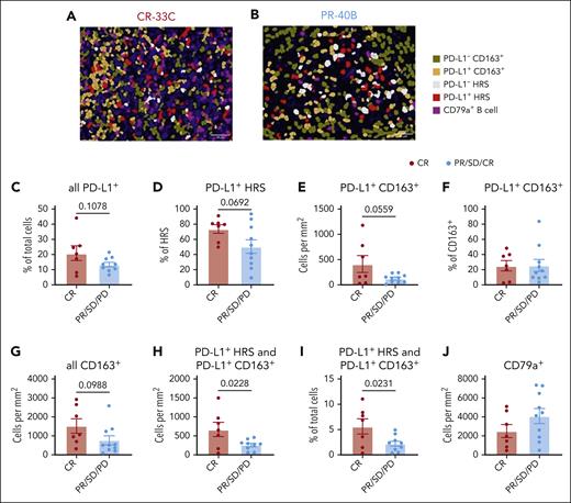 Higher pretreatment fractions of PD-L1+ HRS and PD-L1+ macrophages within the TME are associated with response. mIF imaging was performed to quantify PD-L1 expression, TAMs, and B cells. Cells were phenotyped as PD-L1− CD163+ macrophages, PD-L1+ CD163+ macrophages, PD-L1− HRS cells, PD-L1+ HRS cells, or CD79a+ B cells. Representative images (scale bar, 50 μm) with displayed phenotypes are shown for a patient with CR (A) and a patient with PR (B). The percentage of all TME cells expressing PD-L1 (C), the percentage of HRS cells expressing PD-L1 (D), the density of PD-L1+ CD163+ macrophages (E), the percentage of CD163+ cells expressing PD-L1 (F), and density of all CD163+ macrophages (G) were compared between patients with CR or PR/SD/PD. The combined density of PD-L1+ HRS cells and PD-L1+ CD163+ macrophages (H) as well as their frequency among all TME cells (I) is shown. Similarly, CD79+ B cells densities were compared (J). Statistics are generated using unpaired Student t tests.