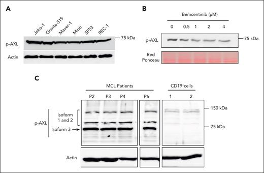 AXL is constitutively activated in MCL cell lines and patient cells. (A) Western blot studies demonstrated the phosphorylation of AXL in all MCL cell lines. (B) JeKo-1 cells were treated with bemcentinib at concentrations ranging from 0.5 to 4 μM. Phosphorylation of AXL was evaluated using a p-AXL antibody. Bemcentinib treatment reduces the level of AXL phosphorylation in MCL cells. (C) AXL phosphorylation status was evaluated in cells from patients with MCL by western blot. The AXL phosphorylation was detectable in all patient–derived MCL cells. The results also indicated that AXL3 is the isoform predominantly activated in primary MCL cells. In contrast, CD19+ B cells from healthy individuals present a weak AXL activation and the complete absence of AXL3 phosphorylation. Experiments were performed in triplicate.