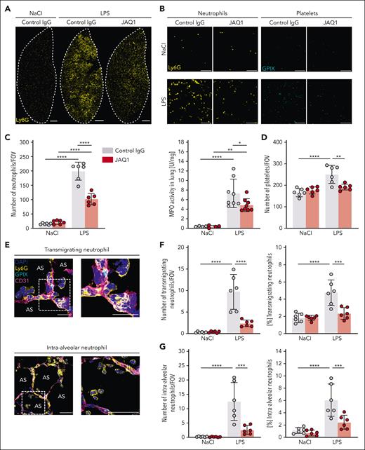 Platelet GPVI is a critical mediator of neutrophil recruitment and transmigration. Immunofluorescence staining of cryosections of the lungs of control or JAQ1-injected mice 4 hours after NaCl or LPS treatment. Images were acquired using a Thunder Imager DMi8 (Leica Microsystems) equipped with a 20× objective (HC PL APO 20×/0.80 DRY, Leica Microsystems) and a Leica-DFC9000GT-VSC12293 camera (Leica Microsystems). (A) Representative micrographs of whole left lung lobes showing extent of pulmonary neutrophil infiltration (Ly6G+, yellow). The dashed line depicts boundaries. Scale bar, 1 mm. (B) Magnified excerpts of a representative single FOV used to quantify neutrophils (Ly6G+, yellow) (left) and platelets (GPIX+, cyan) (right). Scale bar, 80 μm. (C-D) Quantification of neutrophil (C) (left graph) and platelet (D) numbers by manual counting. Neutrophils were identified as structures showing staining for 4′,6-diamidino-2-phenylindole (DAPI) (nucleus) and Ly6G. Spectrophotometric determination of MPO activity in whole lung lysates (C) (right graph). Each data point represents 1 mouse. (E) Representative confocal micrographs of neutrophils (Ly6G+, yellow), platelets (GPIX+, cyan), vessels (CD31+, magenta), and DAPI (nucleus, blue), exemplifying neutrophils counted as transmigrating (top) or intra-alveolar (bottom). Detailed representative images were acquired with a TCS-SP8 confocal laser scanning microscope (Leica Microsystems) with a 63× objective (HC PL APO CS2 63×/1.40 OIL, Leica Microsystems). The dashed line marks the region of the magnified excerpt on the right. (Top) Scale bar, 10 μm; (bottom) scale bar, 30 μm. (F) Quantification of transmigrating neutrophils (left graph) by manual counting. Transmigrating neutrophils were identified as structures showing staining for DAPI (nucleus) and Ly6G, partially protruding into the AS. (G) Quantification of intra-alveolar neutrophils (left graph) by manual counting. Intra-alveolar neutrophils were identified as structures showing staining for DAPI (nucleus) and Ly6G, entirely inside the AS. Each data point represents the average number of neutrophils counted in 30 FOV for 1 mouse. Bars represent mean per group ± standard deviation. The two-way ANOVA with a Šidák multiple comparisons test. ∗P ≤ .05; ∗∗P < .01; ∗∗∗P < .001; ∗∗∗∗P < .0001. AS, alveolar space.