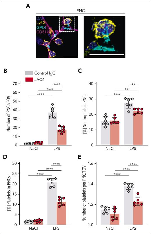 GPVI critically contributes to local platelet–neutrophil interactions in response to LPS. Immunofluorescence staining of cryosections of the lungs of control or JAQ1-injected mice, 4 hours after NaCl or LPS treatment. Images were acquired using a Thunder Imager DMi8 (Leica Microsystems) equipped with a 20× objective (HC PL APO 20×/0.80 DRY, Leica Microsystems) and a Leica-DFC9000GT-VSC12293 camera (Leica Microsystems). (A) Representative confocal micrographs of neutrophils (Ly6G+, yellow), platelets (GPIX+, cyan), vessels (CD31+, magenta), and DAPI (nucleus, blue), exemplifying neutrophils directly interacting with platelets to form PNCs. The dashed line marks the region of the magnified excerpt on the right without the vessel channel. Detailed representative images were acquired with a TCS-SP8 confocal laser scanning microscope (Leica Microsystems) with a 63× objective (HC PL APO CS2 63×/1.40 OIL, Leica Microsystems). Scale bar, 10 μm. (B) Quantification of PNC numbers by manual counting. Each data point represents the average number of PNCs counted in 30 FOVs for 1 mouse. (C) Fraction of the total neutrophil number quantified in Figure 3C that was associated with platelets. Each data point represents mean value for 1 mouse. (D) Fraction of the total platelet number quantified in Figure 3D that was associated with neutrophils. Each data point represents mean value for 1 mouse. (E) Quantification of the number of platelets that associated with a neutrophil in 1 PNC. Each data point represents the average number of platelets that associated with a neutrophil in 1 PNC in 30 FOVs for 1 mouse. Bars represent mean per group ± standard deviation. The two-way ANOVA with a Šidák multiple comparisons test. ∗∗P < .01; ∗∗∗∗P < .0001.