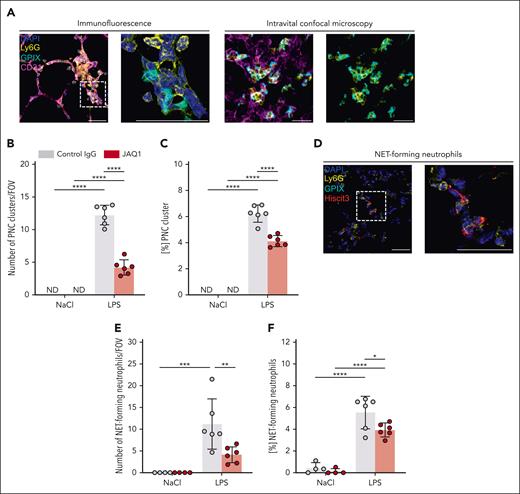 GPVI critically contributes to local neutrophil activation in response to LPS. (A) Representative confocal micrographs of neutrophils (Ly6G+, yellow), platelets (GPIX+, cyan), vessels (CD31+, magenta), and DAPI (nucleus, blue) exemplifying PNC cluster in immunofluorescence-stained cryosections of the lung (left) and during intravital confocal microscopy (right). The dashed line marks the region of the magnified excerpt on the right without the vessel channel. Detailed representative images of immunofluorescence-stained cryosections were acquired with a TCS-SP8 confocal laser scanning microscope (Leica Microsystems) with a 63× objective (HC PL APO CS2 63×/1.40 OIL, Leica Microsystems). Intravital confocal microscopy was performed with a TCS-SP8 confocal laser scanning microscope (Leica Microsystems) with a 25× objective (HC FLUOTAR L 25×/0.95 WATER, Leica Microsystems) after 1 hour of LPS treatment and mice received fluorescently labeled antibody derivates to label neutrophils, platelets, and vessels. Representative images derived from videos of the time interval 40 to 45 minutes showing accumulation of neutrophils as cluster with incorporated platelets. Scale bar, 30 μm. (B) Quantification of PNC clusters by manual counting in lung cryosections. Each data point represents the mean number of PNC clusters in 30 FOV for 1 mouse. (C) Fraction of neutrophils that formed PNC clusters. (D) Representative confocal micrographs of neutrophils (Ly6G+, yellow), platelets (GPIX+, cyan), NETs (Hiscit3+, red), and DAPI (nucleus, blue) exemplifying NET-forming neutrophils in immunofluorescence-stained cryosections of the lung. The dashed line marks the region of the magnified excerpt on the right without the vessel channel. Detailed representative images of immunofluorescence-stained cryosections were acquired with a TCS-SP8 confocal laser scanning microscope (Leica Microsystems) with a 63× objective (HC PL APO CS2 63×/1.40 OIL, Leica Microsystems). Scale bar, 30 μm. (E) Quantification of NET-forming neutrophils by manual counting in lung cryosections. Each data point represents the mean number of NET-forming neutrophils in 30 FOV for 1 mouse. (F) Fraction of neutrophils that formed NETs. Each data point represents mean value for 1 mouse. Bars represent mean per group ± standard deviation. The two-way ANOVA with a Šidák multiple comparisons test. ∗P ≤ .05; ∗∗P < .01; ∗∗∗P < .001; ∗∗∗∗P < .0001. ND, not detectable.