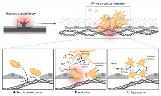 Mechanisms of classical hemostasis after traumatic vessel injury. (A) Traumatic injury leads to exposure of extracellular matrix (ECM) proteins, such as collagen and binding of von Willebrand factor (vWF) derived from endothelial cells and platelets. Adhesion of incoming platelets to the injured vessel wall is mediated by the vWF-binding glycoprotein GPIbα. (B) Activation of recruited platelets and distinct shape change through auto- and paracrine secretion of prothrombotic factors, such as adenosine 5′-diphosphate, leading to an increased affinity of the αIIbβ3/GPIIBIIIA receptor. (C) Binding of fibrinogen activates integrin inside-out signaling pathways, thus promoting aggregation of neighboring platelets and resulting in a stable thrombus formation.