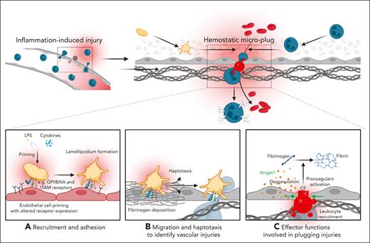 A mechanistic model of key platelet functions in inflammatory hemostasis. (A) Proinflammatory mediators, such as exogenous LPS or endogenous cytokines prime platelets to express a distinct set of receptors, facilitating their adhesion to the inflamed vessel wall and migration is initiated by lamellipodium formation. (B) Through migration and haptotaxis-mediated sensing of density gradients of deposited fibrinogen, platelets detect neutrophil transmigrations sites, which cause vascular breaches and subsequent leakage of red blood cells. (C) Exposed ECM proteins trigger further activation, such as degranulation and PA. Single platelets physically plug injury sites and influence leukocyte recruitment through direct receptor interaction and endothelial-platelet cross talk. Secretion of soluble mediators such as angiopoietin-1 (Angpt1) stabilizes endothelial cell junctions, preventing leukocyte transmigration. Plasmatic coagulation factors such as fibrinogen and thrombin are recruited to the surface of PS–positive procoagulant platelets, which foster local fibrin deposition and act as a single hemostatic plug that further seal endothelial microlesions. We note that this mechanistic model has been shown in LPS-induced acute lung injury and inflammation of both the peritoneum and the cremasteric microcirculation; its relevance in other models of inflammatory bleeding is yet to be examined.