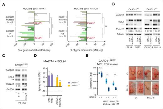 Identification of MALT1 as a target to overcome OAsIs resistance. (A) RNA-seq expression of the 16 genes of the MCL_R16 resistance signature in BCL2A1+CARD11WT cell lines (SP53, NTS3, REC-1) and BCL2A1+CARD11MUT cells (001-024, OCILY3, SUDHL16) treated 24 hours with the BTK inhibitor ibrutinib (500 nM) (left panel) or the MALT1 inhibitor MLT-748 (1 μM) (right panel). Mann-Whitney test; ∗∗∗∗P < .0001. BCL2A1 is shown in red. Genes from bottom to top: CCL4, FABP5, CCL3, BCL2A1, CCL22, NPW, NME1, PTP4A3, PLEK, CD83, SRM, CALR, PA2G4, NCL, SDF2L1, DDX21. (B-C) CARD11, HOIL1, and BCL2A1 protein expression were assessed by immunoblot in indicated cells treated or not with the BTK inhibitor ibrutinib (500 nM) or the MALT1 inhibitor MLT-748 (1 μM) for 24 hours. The arrow highlights cleaved form of HOIL1. (D) Synergy score (HSA method) computed for 4 cell lines treated with venetoclax and MLT-748 for 48 hours. Unpaired t-test; ∗P < .05. Detailed results are represented in supplemental Figure 8C. The mean and SD of 3 independent experiments are represented. (E) Tumor weights at day 16 for CARD11D230N MCL PDX (DFBL44685-v2) treated with the BCL2-i venetoclax (2 nM), the MALT1-i JNJ-67856633 (250-500 nM) or both. n = 5 per group. Mann-Whitney test; ∗∗P < .01. Representative pictures of engrafted tumors in CAM at day 16 are shown in the right panel. n.s., not significant.