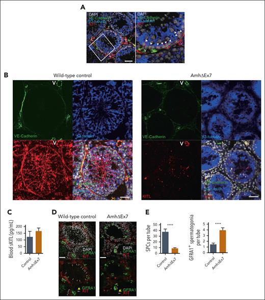 mKITL expression in Sertoli cells is critical for maintenance of Kit+ SPCs in testis. (A) Immunostaining for KIT (red), VE-cadherin (endothelium; green), β3-tubulin (Sertoli cells; blue), counterstained with 4′,6-diamidino-2-phenylindole (DAPI) (nuclear stain; gray) in 4-week-old wild-type mouse testes. Representative of 12 sections from 3 separate mice. Arrow heads: KIT+ spermatogonial precursors adjacent to β3-tubulin+ Sertoli cells. Scale bar represents 50μm. (B) Immunostaining against cytoplasmic domain of mKITL (red), VE-cadherin (green), β3-tubulin (blue), counterstained with DAPI (gray) in 4-week-old AmhΔEx7 and wild-type mouse testes. Representative of 4 to 7 mice of each genotype. Scale bars represent 50μm. (C) Mean (± SEM) blood serum sKITL levels in 4-week old wild-type (control; n = 3) and AmhΔEx7 (n = 7) mice. (D) Immunostaining for KIT (red) and GFRA1 (green), counterstained with DAPI (gray) in 4-week-old wild-type control and AmhΔEx7 mouse testes. White arrows: KIT+ SPCs; yellow arrowhead: GFRA1+ spermatogonia. Representative of 15 mice of each genotype. Scale bars represent 50 μm. (E) Mean (± SEM) KIT+ SPCs and GFRA1+ cells per seminiferous tubule in 4-week-old wild-type (control; n = 19) and AmhΔEx7 (n = 30) testes (mean ± SEM). More than or equal to 50 round cross sections of seminiferous tubules were counted per genotype. The nonparametric Mann-Whitney test for multiple comparisons was used to assess statistical significance. ∗∗∗∗P < .0001. L, KIT+ Leydig cells; V, blood vessel.