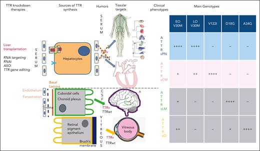 Sources of TTR synthesis, humors where ATTRv and ATTRwt are released, tissular target of misfolded TTR, and main clinical phenotypes according to genotypes. V122I:V102I, D18G, and A34G:R34G.