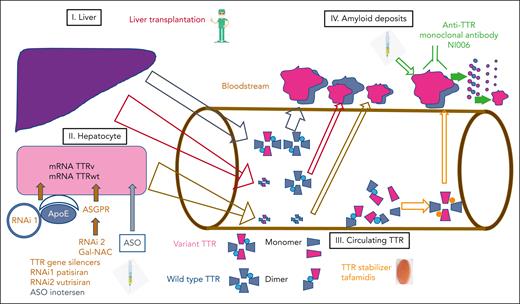 Disease-modifying therapies in ATTRv. Targets of disease-modifying therapies are (1) liver, (2) hepatocytes, (3) circulating TTR, and (4) amyloid deposits in organs (heart, kidneys) and peripheral nervous system.