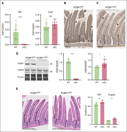 Inducible deletion of PCBP1 specifically in the intestinal epithelium of mouse. (A) Relative levels of PCBP1 mRNA in IECs and livers in PCBP1fl/fl (WT) vs PCBP1ΔIEC (ΔIEC) mice. Weanling mice were fed a tamoxifen diet for 1 month before analysis. mRNA levels from IECs of proximal duodenum were determined by real-time quantitative polymerase chain reaction (qPCR). (B) Detection of PCBP1 in all cells throughout the duodenum of WT mice. Fixed, embedded sections of proximal duodenum analyzed by anti-PCBP1 immunohistochemistry. Brown stain indicates PCBP1. Arrows: epithelial cells. Brackets: duodenal crypts. (C) Specific deletion of PCBP1 in duodenal epithelium of ΔIEC mice. PCBP1 detected by IHC as in panel B, above. Note the absence of brown PCBP1 signal in crypts and epithelial layer with PCBP1 expression in lamina propria and duodenal wall. (D) Absence of PCBP1 protein in immunoblot of IECs from PCBP1ΔIEC mice. IECs were collected and analyzed by immunoblotting for PCBP1 and PCBP2. Representative blot shown on the left, quantitation on the right. (E) Increased villus length and crypt depth in PCBP1ΔIEC mice. Intact, full-length villi and crypts were measured in hematoxylin and eosin–stained sections of duodenum. Mean lengths of structures 1 cm distal to pylorus calculated from each animal; 5 age-matched WT and PCBP1ΔIEC mice were analyzed. Refer to female mice data in supplemental Figure 1.