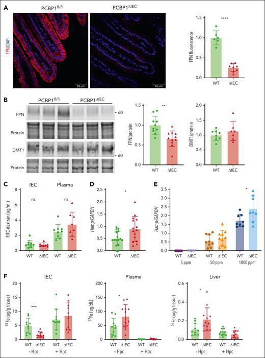 Lower ferroportin levels but higher ferroportin activity in PCBP1ΔIEC mice. (A) Lower levels of ferroportin on duodenal epithelium of PCBP1ΔIEC vs WT mice. Fluorescent immunohistochemistry for FPN in proximal duodenum from 2 months old mice. DAPI (4′,6-diamidino-2-phenylindole) stain indicates nuclei. Representative images on the left show quantitative analysis of fluorescence at right. (B) Lower levels of ferroportin in IECs of PCBP1ΔIEC vs WT mice. IECs from 2 months mice analyzed for FPN and DMT1 by immunoblot. Representative blot on the left, quantitation on the right. (C) Intact tight junctions in intestinal epithelium of PCBP1ΔIEC mice. Mice were administered FITC-dextran (4000 MW) through oral gavage. IECs and plasma were collected after 1 hour and FITC-dextran measured. (D) Higher levels of hepcidin mRNA in livers of PCBP1ΔIEC vs WT mice. Hepcidin mRNA levels in liver were measured by qPCR in 2 months mice. (E) Higher levels of hepcidin mRNA in livers of PCBP1ΔIEC mice on a high-iron diet. Mice were fed defined-iron diets for 1 month and liver hepcidin mRNA levels were analyzed. (F) Ferroportin mediates excess iron absorption through intestinal epithelium of PCBP1ΔIEC mice. Mice were injected intraperitoneally with synthetic hepcidin or vehicle followed by oral gavage with 57Fe solution. IECs, plasma, and liver samples were collected after 1 hour and 57Fe levels measured.