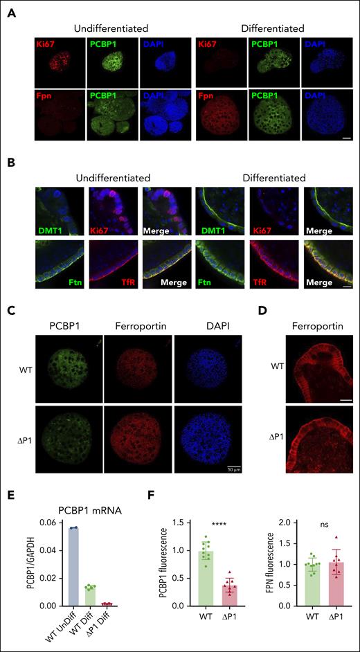 PCBP1 deletion does not suppress ferroportin expression in differentiated enteroids. (A) Expression of PCBP1 and ferroportin in differentiated WT enteroids. Undifferentiated enteroids on the left, differentiated on the right. Enteroids were fixed and analyzed by indirect immunofluorescence. Proliferation marker Ki67 (red, top panel), FPN (red, bottom panel), PCBP1 (green) and DAPI (blue) are shown. Bar = 50 μm. (B) Expression of key iron homeostatic proteins in differentiated enteroids. Enteroids prepared as in panel A were analyzed for DMT1, Ki67, ferritin (Ftn), and transferrin receptor 1 (TfR) as indicated. DAPI staining in blue. Higher magnification and merged images show distinct subcellular localizations. Bar = 10 μm. (C) Depletion of PCBP1 does not affect FPN expression in the enteroids. PCBP1 depletion was induced with 4-OH tamoxifen in differentiating enteroids from PCBP1fl/fl, TG vil-CreERT2 mice. Indirect immunofluorescence for PCBP1, FPN, and DAPI in WT (no tamoxifen) and ΔPCBP1 (tamoxifen) is shown. Quantitation of fluorescent images is shown below in panel F. (D) No change in basolateral localization of ferroportin in PCBP1-depleted enteroids. Higher magnification images of FPN from central sections in WT and ΔPCBP1 enteroids. Bar = 20 μm. (E) Efficient deletion of PCBP1 in differentiated enteroids. Enteroids treated as in panel C were analyzed by qPCR.