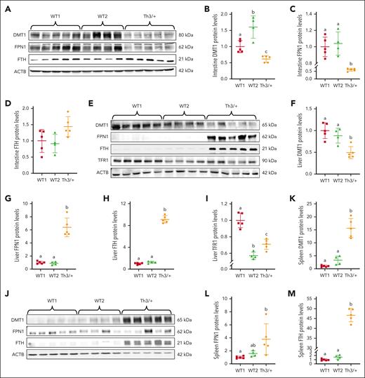 Expression of iron transport- and storage-related proteins in Th3/+ vs WT dams. Expression of DMT1, FPN1, and FTH in the intestine (A-D), the liver (E-I), and the spleen (J-M) was quantified by western blotting. Furthermore, because the liver acquires iron from circulating transferrin, hepatic TFR1 expression was also quantified (E,I). Expression of each protein was normalized to the expression of β-actin. Results represent mean ± SD for n = 4 mice (WT2) or n = 5 mice per group (WT1 and Th3/+) and were analyzed by one-way ANOVA followed by Tukey multiple comparisons test. Groups labeled with different letters are significantly different from one another (P < .05). Significant main effects (from P < .05-P < .0001) noted for all quantification data for panels B-M, except for intestinal FTH (D).