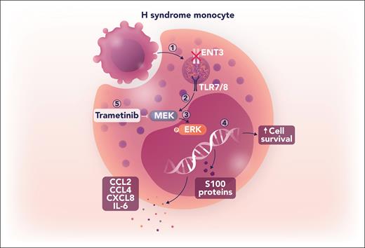 Loss of function of ENT3 activates MAPK signaling through a noncanonical pathway. (1) Following target cell phagocytosis in an H syndrome monocyte, dysfunctional ENT3 prevents translocation of degraded nucleosides into the cytoplasm, resulting in lysosomal accumulation. (2) Accumulation of nucleosides activates TLR7/8, leading to downstream signaling. (3) TLR7/8 signaling stimulates ERK phosphorylation in an MEK-dependent manner. (4) Increased pERK activity alters the transcriptional program to increase production of proinflammatory cytokines, S100 proteins, and the prosurvival protein BCL2A1. (5) Inhibition of MEK signaling with trametinib effectively attenuates inflammatory cytokine production and resolves histiocytic lesions in a patient with H syndrome. IL, interleukin. Professional illustration by Somersault18:24.