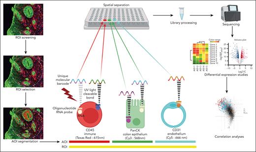 Spatial transcriptomics workflow on the GeoMx Digital Spatial Profiler. Within a delineated ROI, guided sampling of molecular barcodes from the unique fluorescence-segmented AOIs occurs within the instrument. These barcodes are bound to probes against nearly 18 676 RNAs by ultraviolet light-sensitive bonds. Sampling is nonoverlapping and sequential, ensuring spatial separation of probes from each AOI. A library is prepared from the extracted probes and sequenced, and raw data files are generated with information on number of RNA transcripts per gene for every AOI. Differential expression analysis and correlation studies follow, providing leads on disease subtypes and tissue neighborhood interactions. PanCK, pan cytokeratin.