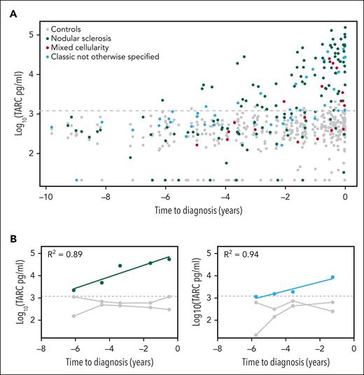 Serum TARC levels before diagnosis of classic HL. Log10-transformed serum TARC levels (pg/mL) in the years before diagnosis are plotted for HL cases and their matched healthy controls. The gray dotted line indicates the 95% quantile among the controls (1206 pg/mL). (A) Results of all 103 HL cases and their controls with histology subtype indicated, showing a steady logarithmic increase of serum TARC levels in cases. (B) Results of the 2 cases with multiple positive samples. R2 is the correlation coefficient.