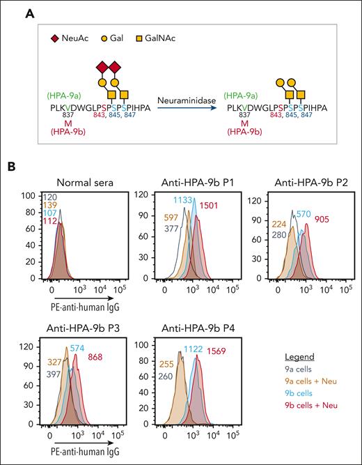 Neuraminidase treatment enhanced HPA-9b alloantibody binding. (A) Schematic of HPA-9 alloantigen and nearby O-glycans. (B) Reactions of anti-HPA-9b patient sera with HPA-9 allele-specific iPSC-derived MKs in the presence or absence of neuraminidase treatment in flow cytometry analysis. Color-coded numbers indicate median fluorescence intensity of corresponding peaks. Binding to HPA-9a cells serves as background binding for individual patient sample. Only P1 serum shows increased background binding to HPA-9a cells after neuraminidase treatment, which may be caused by the presence of unknown anti-carbohydrate antibody against certain desialylated glycan in this case. NeuAc, N-acetylneuraminic acid; Gal, galactose; GalNAc, N-acetyl-D-galactosamine; IgG, immunoglobulin G; Neu, neuraminidase; PE, phycoerythrin.