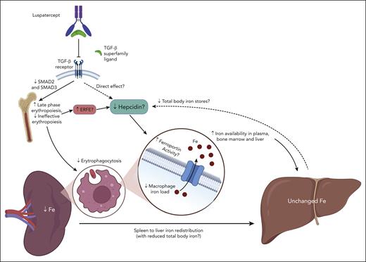 Luspatercept decreases spleen iron content without substantial changes in liver iron content. Hypothetical mechanism(s) proposed by Denton et al,1 which need confirmation by future studies. By improving late-stage erythropoiesis, luspatercept may negatively modulate hepcidin via multiple mechanisms, including the following: (1) increased release of mediators by erythroid progenitors (ERFE? others still unidentified?); (2) direct interference on signaling pathways activating hepcidin, which can also involve TGF-β receptor signaling; and (3) reduction of total body iron stores, to which hepcidin production is generally proportional. These dynamic changes, along with decreased erythrophagocytosis due to reduction of transfusion burden and IE, may promote ferroportin activity in splenic macrophages, leading to increased iron egress from the spleen, as well as increased iron availability in plasma, bone marrow, and liver, favoring iron redistribution and increased iron chelation efficacy. Question marks denote mechanisms that need confirmation. Figure created with BioRender.com.