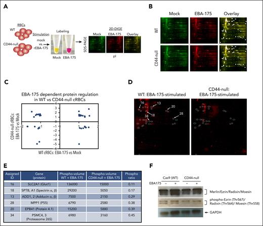 CD44 facilitates EBA-175-induced signaling to the RBC cytoskeleton. (A) Schematic of 2D-DIGE assays. (B) 2D-DIGE analysis of WT or CD44-null cRBC lysates stimulated with mock or RII EBA-175. Circles represent spots with ≥1.3 fold change in intensity in mock- vs RII EBA-175–stimulated samples in 1 or both genetic backgrounds as identified by DeCyder analysis. (C) Quantification of the fold change in intensity in RII EBA-175–stimulated vs mock-stimulated WT cRBCs, and RII EBA-175–stimulated vs mock-stimulated CD44-null cRBCs. Spots identified with >1.3-fold change in intensity were plotted. (D) 2D-DIGE analysis of protein phosphorylation in WT vs CD44-null cRBCs stimulated with RII EBA-175. The circles indicate 25 spots with ≥2-fold increase in phosphorylation in the stimulated WT cRBCs compared with CD44-null cRBCs. The 6 spots that were sent for identification by mass spectrometry analysis are indicated. (E) High-confidence proteins identified by mass spectrometry of 2D-DIGE spots with differential phosphorylation between EBA-175–stimulated WT vs CD44-null cRBCs. Phospho-volumes were quantified by Applied Biomics using DeCyder software. (F) Western blot for total and phosphorylated ERM complex proteins (merlin, ezrin, radixin, and moesin) WT or CD44-null cRBCs stimulated with mock vs RII EBA-175. Anti-ERM was used at 1:1000, anti–phospho-ERM was used at 1:1000, and anti-GAPDH (1:4000) was used as a loading control, followed by goat anti–rabbit-HRP (1:4000).
