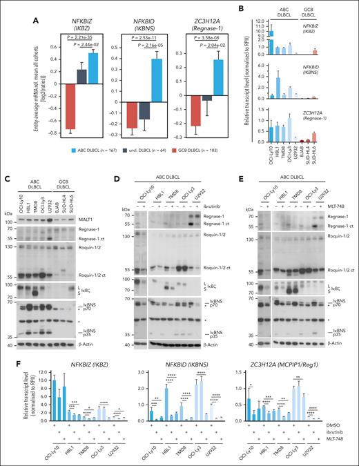 Expression and regulation of MALT1 protease–dependent genes in ABC DLBCL. (A) Differential gene expression for n = 414 cases (167 ABC-like DLBCL, 64 unclassified, and 183 GCB-like DLBCL; Gene Expression Omnibus accession GSE10846) for the genes ZC3H12A, NFKBIZ, and NFKBID in ABC, unclassified, and GCB DLBCLs. (B) Relative transcript expression of ZC3H12A, NFKBID, and NFKBIZ by qRT-PCR in a panel of ABC and GCB DLBCLs; n ≥ 3, all error bars depict the mean ± SD. (C) Western blot analysis of MALT1 substrates Regnase-1 and Roquin-1/2 and their targets IκΒζ and IκBNS in a panel of ABC and GCB DLBCL cells. Unspecific bands are marked with an asterisk. (D-E) Western blot analysis of (D) ibrutinib- or (E) MLT-748–treated ABC DLBCL. Activity of the MALT1 protease was determined by cleavage of Regnase-1 and Roquin-1/2 and their targets IκBζ and IκBNS. “L” and “S” depict long and short IκBζ isoforms, respectively. Unspecific bands are marked with an asterisk. (F) Transcript analysis of ZC3H12A, NFKBIZ, and NFKBID after inhibition with ibrutinib or MLT-748 in ABC DLBCL. n = 4, all error bars depict the mean ± SD; ordinary 1-way ANOVA with Dunnett multiple comparisons; ∗P < .05; ∗∗P < .01; ∗∗∗P < .001; and ∗∗∗∗P < .0001.