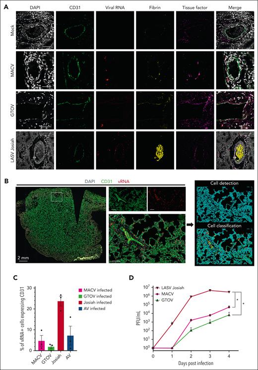 Differences in tropism for endothelial cells between hemorrhagic fever-causing arenaviruses. (A) Multiplex immunofluorescence and ISH staining of kidney sections from infected or mock-infected animals. Single channel images of DAPI, CD31 (vascular endothelial cells), fibrin, viral RNA, and TF are shown as well as their merge. Images are representative of observations made in 3 separate animals for each condition. Scale bar corresponds to 50 μm. (B) Whole-slide images obtained by confocal scanner. Three slices in the Z dimension were transformed by maximum intensity projection. Left image shows a whole lung from a LASV Josiah-infected animal with the 3 staining merged. The 3 images in the center correspond to the white inset and allow appreciation of the staining localization at a cellular level. It includes a medium caliber vessel surrounded by alveoli. Scale bars = 50 μm. The 2 images on the right are from QuPath software and illustrate the process of cell detection based on DAPI staining and cell classification based on CD31 and vRNA positivity. Color-coding: blue = unclassified; green = CD31+ vRNA–; yellow = CD31+ vRNA+; red = CD31– vRNA+. (C) Quantification of the classification obtained in the previous analysis. Three organs for each condition were quantified. (D) Infectious particles titers in the supernatant of HUVEC infected with 3 different hemorrhagic fever-causing arenaviruses, harvested at 5 different time points after infection. Error bars correspond to the standard error of the mean of 3 replicates, asterisks signal a statistically significant difference between titers at 4 DPI according to a two-tailed Mann-Whitney test (P < .05).