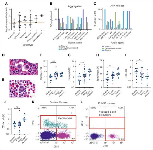 Platelet electron microscopy, aggregometry, and BMw evaluation. Average number of dense granules per platelet in each patient tested, compared according to the type of variant (A). Normal cutoff for adults is 1.2 granules/platelet (dotted orange line). Bars indicate mean and 1 standard deviation. Percentage of patients with normal, delayed/decreased, or absent platelet aggregation (B) and adenosine triphosphate release (C) in response to various platelet agonists. Representative BM histology of FPDMM patients showing small megakaryocytes with hypolobation (D) or separated nuclear lobes (E). BM flow cytometry analysis quantified percentage of monocytes of all nucleated cells based on expression of CD14 and CD64 (F), eosinophils of all cells based on expression of CD45, CD16 and side light scatter (G), lymphocytes of all cells based on CD45, CD3, CD19, and CD56 (H), CD4:CD8 ratios of CD3+ T cells (I), and CD34+ cells of all nucleated cells (J). Mann Whitney statistical analysis compared BM of controls (n = 16) vs FPDMM adults without malignancy (n = 24) (blue dots). Three FPDMM adults diagnosed with a myeloid malignancy (1 CMML and 2 MDS) are indicated by red dots but were not included in the statistical analysis which sought to evaluate differences in baseline (nonmalignant) patients with FPDMMvs controls. Pediatric patients with FPDMM without a malignancy were separated in the analysis as healthy pediatric controls were not available for comparison. Black horizontal lines refer to median. ∗P < .05; ∗∗P < .01; ∗∗∗P < .001. Flow cytometry shows normal CD10+ B-cell precursors in a healthy marrow (K), compared with an FPDMM marrow (L) showing absence of CD10+ B-cell precursors. AA, arachidonic acid; ADP, adenosine diphosphate; Avg, average.