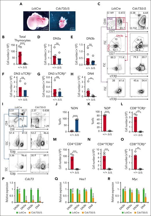 Cdc73 is important for Notch-dependent T-cell development. (A-H) Representative images of thymuses (A); absolute thymocyte counts (B); representative flow cytometric profiles of DN subsets (C); and absolute numbers of DN3a (D), DN3b (E), DN3 icTCRβ− (F), DN3 icTCRβ+ (G), and DN4 (H) subsets in LckCre control and LckCre Cdc73f/f(Cdc73Δ/Δ) mice. (I-O) Representative flow cytometric profiles of CD4/CD8 subsets (I); %DN (J); %DP (K); and absolute numbers of immature single-positive (ISP) (L), DP (M), CD4 single-positive (SP) (N), and CD8 SP (O) thymic subsets in LckCre control and Cdc73Δ/Δ mice. DN3a = Lineage−CD44−CD25+FSCloCD27−; DN3b = Lineage−CD44−CD25+FSChiCD27+; DN4 = Lineage−CD44−CD25−; ISP = CD8+TCRb−; DP = CD4+CD8+; CD4 SP = CD4+TCRb+; And CD8 SP = CD8+TCRb+. ∗P < .05; ∗∗P < .01; ∗∗∗P < .001; ∗∗∗∗P < .0001. (P-R) Relative expression of Cdc73 (P), Hes1 (Q), and Myc (R) in sorted thymic subsets from LckCre mice (green) and Cdc73Δ/Δ mice (orange). FSC, forward scatter; icTCR, intracellular T-cell receptor; ns, not significant.