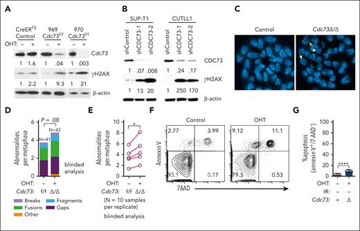 Cdc73 is important for genome integrity. (A) Western blot for γH2AX in Rosa26CreERT2Cdc73f/f T-ALL cells (969 and 970) and control Rosa26CreERT2 T-ALL cells treated with OHT for 30 hours to delete Cdc73. Numbers represent band intensities normalized to β-actin loading control. (B) Western blot for γH2AX in human NOTCH1-induced human T-ALL cell lines (SUP-T1; CUTLL1) transduced with shCDC73. (C-E) Representative metaphase spreads (C) and quantification of metaphase abnormalities in aggregate (D) or per replicate (E) in blinded analyses of Cdc73f/f T-ALL cells treated with OHT for 30 hours. White arrows represent gaps; orange arrow represents break. (F-G) Representative Annexin V/7-AAD flow cytometric plots (F) and Annexin V+/7-AAD− scatterplot (G) of Cdc73f/f T-ALL cells treated with vehicle (Control) or OHT for 30 hours (Cdc73Δ/Δ). 7-AAD, 7-aminoactinomycin D.