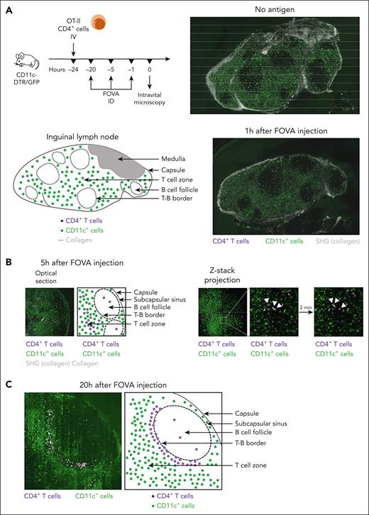 Interaction with APCs in response to FVIII drives CD4+ T cells to the T-B border. (A) Multiphoton IVM of inguinal LNs in C57BL/6 CD11c-DTR/GFP mice. Twenty-four hours before microscopy, CD4+ T cells were magnetically sorted from OT-II mice, labeled with CTV, and adoptively transferred to the experimental animals. FOVA (5 μg) was injected intradermally in the groin area 1, 5, or 20 hours (n = 2 per time point) before microscopy. LNs were surgically exposed in anesthetized mice and imaged in vivo on an inverted Leica SP8 confocal/multiphoton microscope with a HCX IRAPO L 25×/0.95 water dipping objective. During imaging, the core body temperature of the animals was maintained at 36°C to 37°C with a temperature controller consisting of a rectal probe and a heating pad. Imaging data were collected and processed using Leica LASX software. Sixty-minute time series were captured with Z-stacks collected once every minute for each time point to a depth of ∼100 μm. The full-field views show whole LNs in animals without a FOVA injection (no antigen) and 1 hour after a FOVA (5 μg) injection, with observable CD11c+GFP+ cells (green), collagen (gray), and CD4+CTV+ cells (purple). The schematic diagram indicates presumed LN compartments with areas densely populated by bright CD11c+GFP+ cells (green) representing the T-cell zones and dark round areas representing the B-cell follicles. (B) Optical section and Z-stack projection views of T-cell zone and B-cell follicle areas, 5 hours after a FOVA (5 μg) injection. White triangles indicate an example CD4+ T-cell cluster in the T-cell zone around a CD11c+GFP+ cell interacting with 2 different T cells, 2 minutes apart. (C) Optical section of the T-B border 20 hours after a FOVA (5 μg) injection.