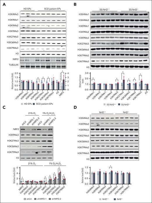 Nrf2 expression affects histone methylation in SCD. (A) Histone methylation and NRF2 levels in EPs from HD and patients with SCD. EPs from HDs and patients with SCD were cultured in a modified Fibach 2-phase culture system, and on day 12 of culture, they were determined using the indicated histone and NRF2 antibodies. (B) Histone methylation in the histone extracts of spleen Ter119+ cells from SS/Nrf2+/+ and SS/Nrf2–/– mice. (C) Histone methylation in 12-day EPs from patients with SCD cultured under normoxia (21% O2), treated with H2O2 (200 μM) and hypoxia (1% O2), H2O2. (D) Histone methylations in non-SCD C57BL/6 mice were determined using the indicated antibodies in the spleen Ter119+ cell histone extracts of adult Nrf2+/+ and Nrf2–/– mice. Total histone H3 was used as a loading control. Data represent mean ± SD; n = 3 to 6. ∗P < .05. HD, healthy donor.