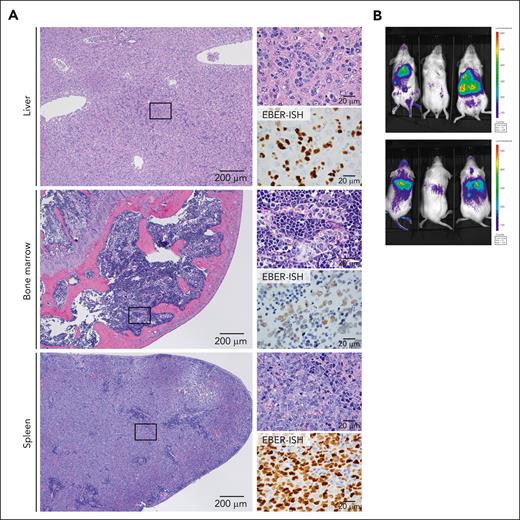 ANKL-PDXs reproduce human clinical features. (A) Hematoxylin and eosin (H&E) staining (left: low-power field; upper-right: high-power field) and EBV-encoded RNA in situ hybridization (EBER-ISH) (lower-right) of the liver, BM, and spleen sections derived from an ANKL1 PDX mouse. Representative image from 3 independent experiments. Scale bar, 200 μm (low-power field) and 20 μm (high-power field). (B) Bioluminescent signal detected using the IVIS in ANKL1 PDX mice (n = 3). The upper and lower panels show the supine and prone positions, respectively.