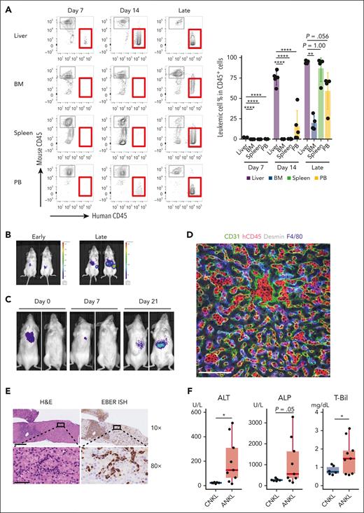 ANKL cells primarily proliferate in the liver. (A) The percentage of leukemic cells in each organ of PDX mice analyzed by flow cytometry at days 7 and 14 and 3 to 4 weeks when mice already became weak (late) after splenic ANKL1 cell injection at a dose of 1 × 103 cells (n = 4-5). (B) IVIS imaging of an ANKL1 PDX mouse at an early (1-2 weeks after transplantation) and late (3-4 weeks when mice already got weakened) phase. (C) IVIS imaging at days 0, 7, and 21 after hepatic ANKL1 cell subcutaneous injection at a dose of 1 × 107 cells. Representative image from 3 biological replicates. (D) Expression of CD31, hCD45, F4/80, and desmin in the liver of an ANKL1 PDX mouse. Data are representative of 2 experiments. Scale bar, 100 μm. (E) H&E staining (left) and EBER-ISH (right) for a liver section from a biopsy sample of a patient with newly diagnosed ANKL. Upper and lower images show the ×10 and ×80 original magnification, respectively. Scale bar, 300 μm (×10) and 50 μm (×80). (F) Comparison of liver function between patients with chronic NK-cell lymphocytosis (CNKL) and those with ANKL. Clinical data of alanine transaminase (ALT, left), alkaline phosphatase (ALP, middle), and total bilirubin (T-Bil, right) from the previous study were reanalyzed.22 ∗P < .05; ∗∗P < .01; ∗∗∗P < .001; ∗∗∗∗P < .0001.