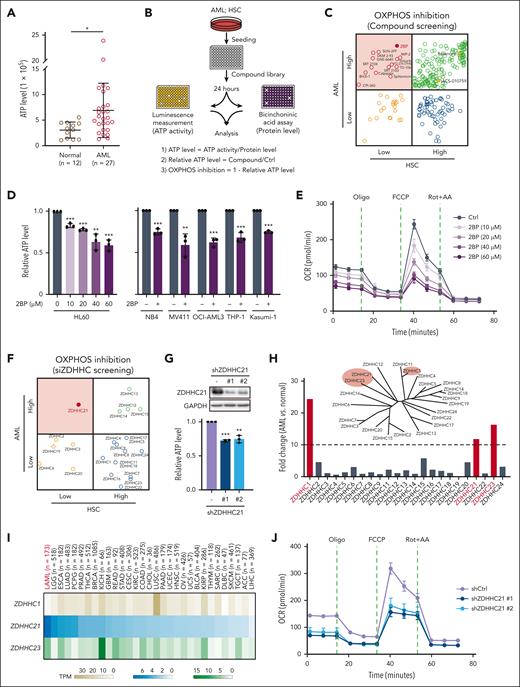 Highly expressed ZDHHC21 specifically regulates OXPHOS hyperactivity in AML cells. (A) The ATP level of healthy donors and patients with AML. (B) Schematic representation of the compound screen. Cellular ATP levels were measured by an enhanced ATP Assay Kit. ATP levels were normalized to their protein concentrations. (C) Relative OXPHOS inhibition in AML cells and HSCs. HL60 cells and HSCs were treated with a collection of 267 PTM inhibitors (10 μM) for 24 hours. Compounds that selectively inhibited OXPHOS in AML cells rather than HSCs are indicated with red circles. Rotenone and IACS-010759, indicated with yellow solid circles, were the positive controls to suppress OXPHOS. (D) The inhibitory effect of 2BP on ATP production in AML cells. HL60 cells were treated with 2BP at a series of concentrations (0, 10, 20, 40, 60 μM), and other cells lines were treated at a single concentration, including NB4 (60 μM), MV411 (40 μM), OCI-AML3 (60 μM), THP-1 (60 μM), and Kasumi-1 (60 μM). ATP levels were normalized to their protein concentrations. (E) Mitochondrial OCR of HL60 cells after treatment with control (DMSO) or 2BP for 24 hours. (F) Relative OXPHOS inhibition in AML cells and HSCs. HL60 cells and HSCs were transfected with small interfering RNAs targeting ZDHHCs for 72 hours. (G) Top: the protein levels of ZDHHC21 were measured by western blotting to evaluate the silencing efficiency of different shRNA (#1 and #2) against ZDHHC21 in HL60 cells for 5 days. Bottom: cellular ATP levels of shZDHHC21-transfected HL60 cells for 5 days. ATP levels were normalized to their protein concentrations. (H) Relative fold change of gene expression for 173 patients with AML and 70 normal controls obtained from the GEPIA database. The phylogenetic tree represents the sequential evolutionary relationships of a set of ZDHHC family. (I) The expression levels of ZDHHC1, ZDHHC21, and ZDHHC23 were analyzed in 31 cancer species using the GEPIA database. (J) Mitochondrial OCR of HL60 cells infected with lentivirus-shZDHCH21s for 5 days. Data are presented as mean ± SD (n = 3). n.s., P > .05; ∗P < .05; ∗∗P < .01; ∗∗∗P < .001. The significance analysis was conducted by a two-tailed unpaired t test or one-way analysis of variance. AA, antimycin A; Ctrl, control; FCCP, fluoro-carbonyl cyanide phenylhydrazone; rot, rotenone.
