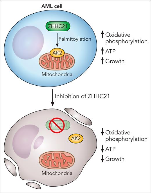 Palmitoylation of target proteins, by the palmitoyltransferase ZHHC21, maintains oxidative phosphorylation and is necessary for the viability of AML cells and stem cells. AK2 is palmitoylated by ZHHC21, and AK2 palmitoylation is necessary for its localization to the mitochondria where it regulates oxidative phosphorylation. Chemical or genetic inhibition of ZHHC21 prevents the localization of AK2 to the mitochondria, decreases oxidative phosphorylation, reduces ATP, and inhibits the growth and viability of AML cells. Professional illustration by Patrick Lane, ScEYEnce Studios.
