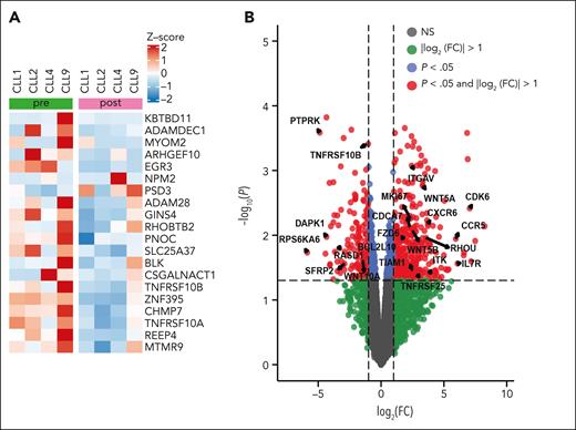 Transcriptomic changes associated with venetoclax progression in patients with loss(8p). (A) Normalized counts from RNA-seq data for the top 25 genes transcribed from chromosome 8p, based on mean difference in pre- and postvenetoclax progression in samples of the loss(8p) cohort (CLL1, CLL2, CLL4, and CLL9). (B) Volcano plot showing differentially expressed genes from RNA-seq data comparing samples from patients with or without loss(8p). The log2FC is plotted on the x-axis, and the negative-log10 adjusted P value (using FDR) is plotted on the y-axis. Genes marked in red show differentially expressed genes with an absolute value of log2 (FC) no less than 1 (FC = 2) and adjusted P value < .05.