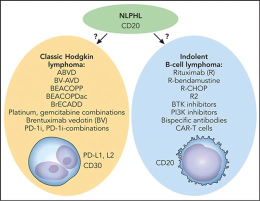 Medical therapy for NLPHL: tradition vs biology. The key question is whether to treat with Hodgkin lymphoma–directed therapy (left) or as an indolent B-cell lymphoma (right). BEACOPDac, bleomycin, etoposide, doxorubicin, cyclophosphamide, vincristine, prednisone, dacarbazine; BEACOPP, bleomycin, etoposide, doxorubicin, cyclophosphamide, vincristine, procarbazine, prednisone; BrECADD, brentuximab vedotin, etoposide, cyclophosphamide, doxorubicin, dacarbazine, dexamethasone; BV-AVD, brentuximab vedotin plus doxorubicin (Adriamycin), vinblastine, and dacarbazine; R-CHOP, rituximab plus cyclophosphamide, doxorubicin, vincristine, and prednisone. Professional illustration by Patrick Lane, ScEYEnce Studios.