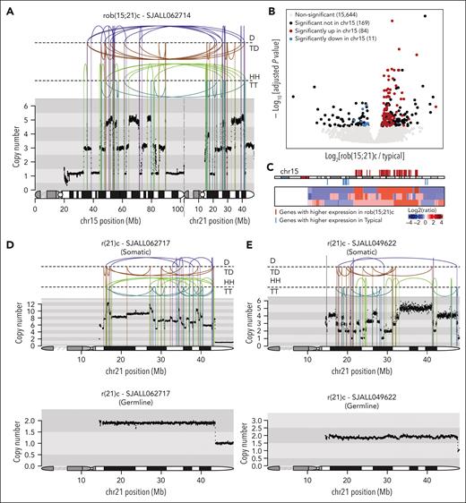 Copy number and gene expression profiles for rob(15;21)c and r(21)c iAMP21-ALL cases. (A) Example of the copy number and rearrangement profile of the der(15;21) chromosome for patient SJALL062714 with rob(15;21)c. Copy number is indicated on the y-axis, and the chromosome 15 and 21 ideograms are shown along the bottom of the plot to indicate breakpoint location. Rearrangements are separated based on their orientation: (B) Volcano plot comparing gene expression pattern between rob(15;21)c and typical subgroups. Only those cases in the main iAMP21-ALL cluster of Figure 1B with matched WGS and WTS were used in this analysis. Two hundred sixty-four genes showed significant differences (adjusted P value < .05), including 95 (36%) on chromosome 15 (84 and 11 upregulated and downregulated, respectively in rob(15;21)c compared with typical groups). (C) Heatmap showing the copy-number profile of chromosome 15 for 3 rob(15;21)c cases with matched WGS and WTS. Log2 ratios of copy number calculated based on the tumor and germ line samples for each case were used, with red and blue showing copy number amplification/gain and deletion, respectively. Each row represents a sample. The ideogram for chromosome 15 is shown on the top of the heatmap. Genes with significantly higher and lower expression in rob(15;21)c compared with those in typical cases are shown in red and blue, respectively, and listed in supplemental Table 8. (D-E) Rearrangement and copy number patterns of 2 cases with r(21)c: SJALL062717 (D) and SJALL049622 (E). Somatic and germ line profiles are shown at the top and bottom, respectively. Rearrangements are separated based on their orientation. D, deletion; HH, head-to-head inverted; TD, tandem duplication; TT, tail-to-tail inverted.