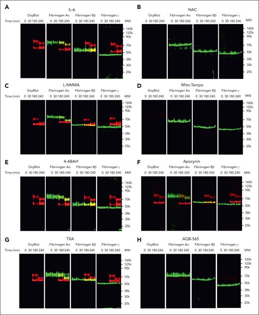 NAC, Mito-Tempo, and AQB-565-inhibitable ROS are responsible for oxidation and proteolysis of fibrinogen in IL-6–stimulated leukocytes. IL-6–stimulated RBC-lysed leukocytes from healthy donors (n = 6) were incubated with fibrinogen (4 mg/mL) and indicated various antioxidants and inhibitors as described in supplemental Methods; supplemental Figure 8B for indicated time periods. (A-H) Conditioned medium was analyzed by OxyBlot and immunoblotting using fibrinogen Aα-, Bβ-, and γ-specific antibodies. Data images are representative of 4 independent experiments.