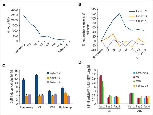 Blood response upon DMF treatment depends on SC cell death sensitivity and NF-κB activity. (A) Time curve of the Sézary cells (SC) count of the only patient that responded on DMF therapy with a CR. Depicted are the SC values throughout the study (visit number reflects sampling every 4 weeks) in absolute number per μL. (B) Change in spontaneous CD4+ T-cell death rate in patient 2 (responder) and patients 3 and 4 (nonresponders) throughout the study. Spontaneous cell death was measured directly in CD4+ T cells freshly isolated from patients. (C) DMF sensitivity reflected by DMF-induced cell death in the CD4+ T cells of patients 2, 3, and 4 throughout the study. DMF-induced cell death was measured after stimulation of isolated CD4+ T cells of the respective patients with 30 μM DMF for 24 hours. (D) Specific luminescence in the NF-κB luciferase assay in isolated CD4+ T cells from patients 2, 3, and 4 spontaneously at 0 hours and 24 hours after transfection with treatment with 50 μM DMF for 24 hours. The specific NF-κB activity is normalized to a control plasmid and depicted as the ratio of both luminescence values.