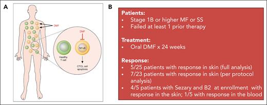 (A) Mechanism of DMF action in CTCL. DMF inhibits NF-κB activity in CTCL cells, inducing their apoptosis, while having minimal effect on healthy T cells. Professional illustration by Patrick Lane, ScEYEnce Studios; reproduced from Vancurova.11 (B) Clinical trial summary for the phase 2 study of DMF in CTCL.