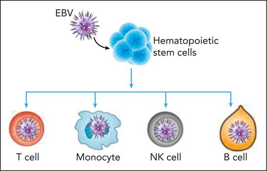 EBV infection of hematopoietic stem cells drives these cells to produce progeny along the differentiation hierarchy, leading to expansion of EBV-infected monocytes, T cells, NK cells, and B cells in CAEBV disease.