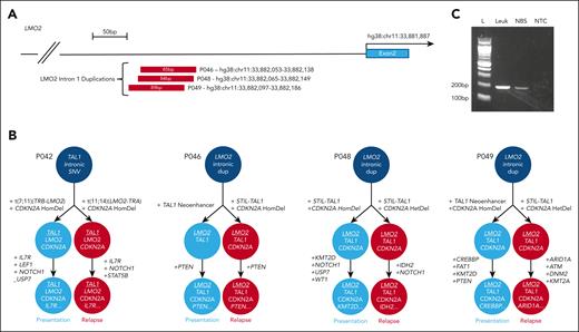 Noncoding lesions unite initial diagnostic and late relapse leukemias. (A) Schematic representation of LMO2 intron 1 duplications identified in 3 cases. (B) Order of acquisition of mutations in initial diagnostic and relapse cases, demonstrating the initiating noncoding lesion that unites the 2 leukemias. (C) Agarose gel of polymerase chain reaction products confirming presence of the noncoding LMO2 duplication in the neonatal blood spot sample from patient P049. Polymerase chain reaction product was confirmed on Sanger sequencing. Lane M, 100-bp molecular weight ladder; lane 1, P049 presentation sample DNA; lane 2, P049 neonatal blood spot DNA; lane 3, no template (water) control. dup, duplication; HomDel, homozygous deletion; L, ladder; Leuk, leukemia; NBS, neonatal blood spot; NTC, nontemplate control.