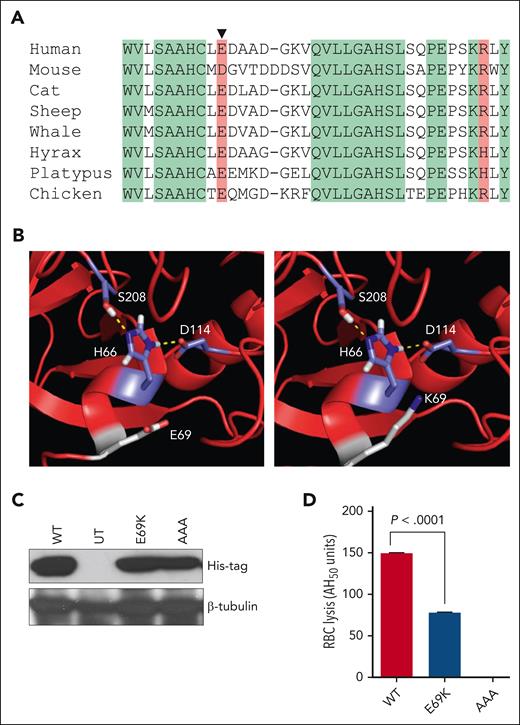 Identification and functional characterization of CFD E69K. (A) Sequence alignment of complement factor D (CFD) showing conservation across diverse species of a negatively-charged residue, glutamic acid (E) or aspartic acid (D), at position 69 (arrowhead). Green shading denotes exact sequence conservation, red shading denotes conservation of amino acid charge. (B) Structural modeling of the catalytic triad of CFD WT (left) compared to CFD E69K (right) (Protein Data Bank: 2XWB). (C) Whole cell lysates from HEK-293T cells expressing CFD WT, CFD E69K (E69K), or catalytic-dead CFD (HDS/AAA), in which the catalytic triad residues histidine 66, aspartic acid 114 and serine 208 were replaced with alanines, were subjected to western blot analysis to quantify the total expression of each variant in each cell line. Untransfected (UT) HEK-293T cells were used as a negative control for CFD expression. (D) Red blood cell lysis assay results for human CFD-deficient serum reconstituted with the indicated CFD variants. Data shown are representative results of at least 3 independent experiments.