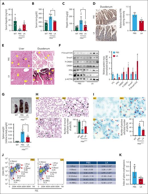 LA ameliorates iron burden in Hbbth3/+ mice. Four-week-old Hbbth3/+ mice were treated with intravenous LA (150 mg/g body weight) or vehicle for 4 weeks (n = 4-5 mice per group). (A-C) Serum hepcidin levels (A) and serum (B) and hepatic tissue (C) iron contents of wild-type (WT) and Hbbth3/+ mice in response to LA administration. (D) Immunohistochemical staining of FPN on duodenum sections (×100) from Hbbth3/+ mice after LA administration, with quantitative analysis in the right panel. (E) Enhanced DAB iron staining of liver (×200) and duodenum (×200) sections from Hbbth3/+ mice with LA treatment. Brown represents iron deposition (denoted by yellow arrows). (F) Western blotting of Smad1, P-Smad1/5/8, CREB1, P-CREB1, FPN, and FTL in liver specimens from LA-treated mice relative to untreated control, with quantitative analysis in the right panel. (G) Spleen morphology (the upper panel) and spleen weight per body weight (the lower panel) of WT and Hbbth3/+ mice treated with LA or solvent. (H) Blood smears stained with Wright-Giemsa stain, with black arrows indicating damaged or deformed erythrocytes (×1000) and quantification of normal cells. (I) Reticulocyte counts were performed using new methylene blue staining with red arrows indicating positive cell (×1000) and quantification of positive cells. (J) Representative erythropoiesis profiles of bone marrow from Hbbth3/+ mice treated with LA or PBS. (K) Index of splenic erythropoiesis (as calculated by spleen weight × % spleen erythroid cells determined in flow cytometry analysis). ∗P < .05 and #P < .001, relative to untreated WT mice or as indicated. Data are represented as mean ± standard deviation. Baso, basophilic erythroblasts; Ortho, orthochromatic erythroblasts; Poly, polychromatic erythroblasts; Pro, proerythroblasts; Retic, reticulocytes.