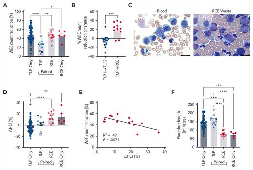 RCE effectively reduces the WBC count and corrects anemia in patients with hyperleukocytosis. (A) Percent WBC count reduction. (B) The difference in percent WBC count change between TLP1/TLP2 (blue filled circles) or TLP/RCE (red filled circles). (C) Micrographs of a Wright's stained peripheral blood smear from a patient with AML with monocytic features (left) and of a Wright's stained smear from the RCE waste bag from the same patient (right), 100× magnification. (D) Percent hematocrit change. (E) Percent change in hematocrit compared with percent reduction in WBC count in patients undergoing RCE either alone or following failed TLP for whom ending hematocrit was deliberately increased. (F) TLP or RCE procedure length. (A,D,F) TLP alone is defined by blue filled circles; paired TLP and RCE by blue and red shapes, with each shape representing an individual patient; and RCE alone by red filled circles. All analyses of variance with multiple comparisons were one-way unless otherwise specified: (A) ∗P = .024, ∗∗P = .0037, ∗∗∗∗P < .0001. (B) ∗∗∗P = .0001 unpaired t test. (D) ∗∗P = .0025, ∗∗∗∗P < .0001. (E) P = .0071, R2 = .47, simple linear regression. (F) ∗∗∗P = .0002, ∗∗∗∗P < .0001. (A,D,F) All comparisons not marked by an asterisk are P > .05.