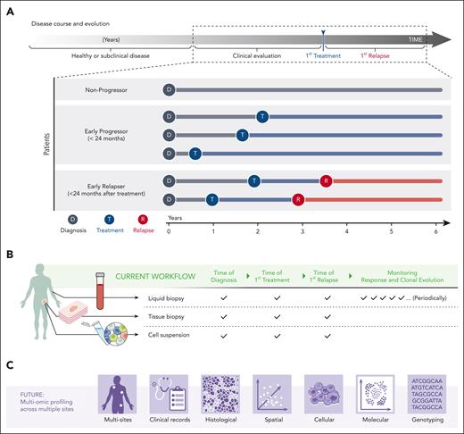 Longitudinal study of clonal evolution. (A) FL has a spectrum of clinical behaviors that evolve over several years. The time from diagnosis to first treatment and to first relapse vary significantly across patients and are unpredictable at diagnosis. (B) Tools to study the biology of FL over time are evolving beyond tissue biopsies and include liquid biopsies at key landmark time points (time of diagnosis, time of first treatment, and time of first relapse). Liquid biopsies additionally empower longitudinal monitoring of the clinical response and clonal evolution. Excisional biopsies provide material for histological studies (tissue biopsy) and dissociated single cell and sequencing methods (cell suspension). (C) Future workflows may include profiling multiple LNs via multiomic technologies and integrating this data to obtain a holistic portrait of cell-intrinsic and extrinsic factors governing clinical outcome.